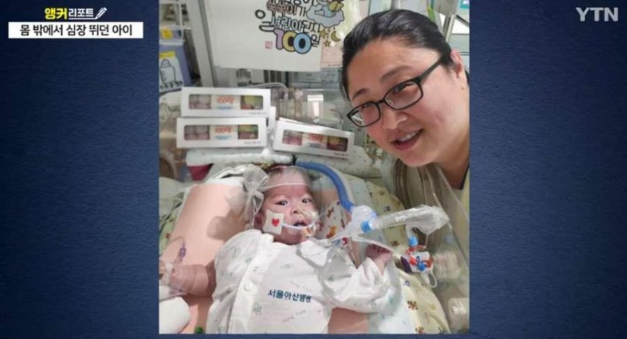 혐) 심장이 밖에서 뛰는 심장이소증, 국내 최초 수술 성공