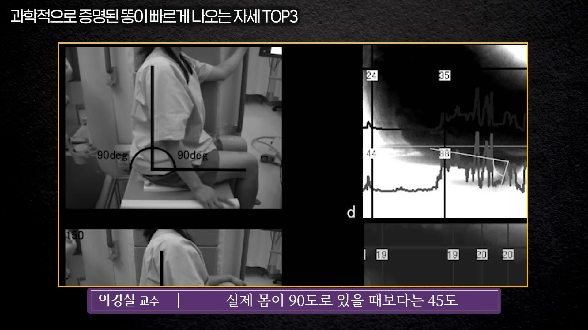 응가 닦는 방향과 응가 잘 나오는 자세 알려드림