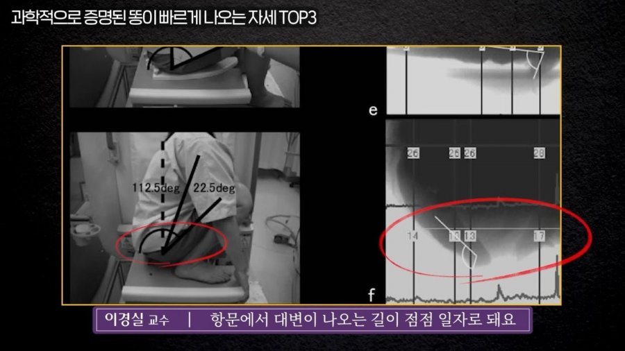 똥 닦는 방향과 똥 잘 나오는 자세