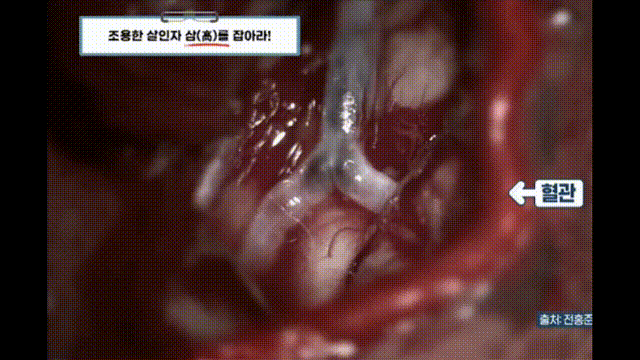 심근경색의 대표적인 전조증상.jpg
